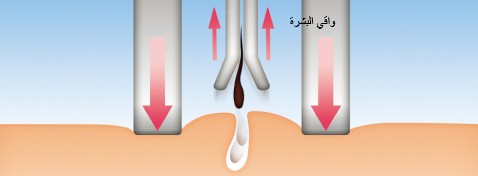 واقي البشرة لتقليل الشعور بالألم