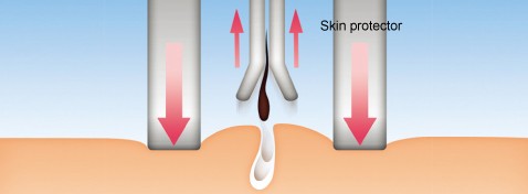 Skin Protector Aufsatz für eine besonders sanfte Epilation