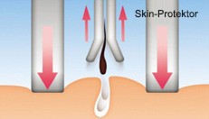 Skin-Protektor-Aufsatz für weniger Schmerz
