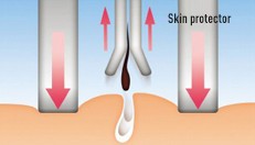 Protecteur de peau pour une épilation moins douloureuse