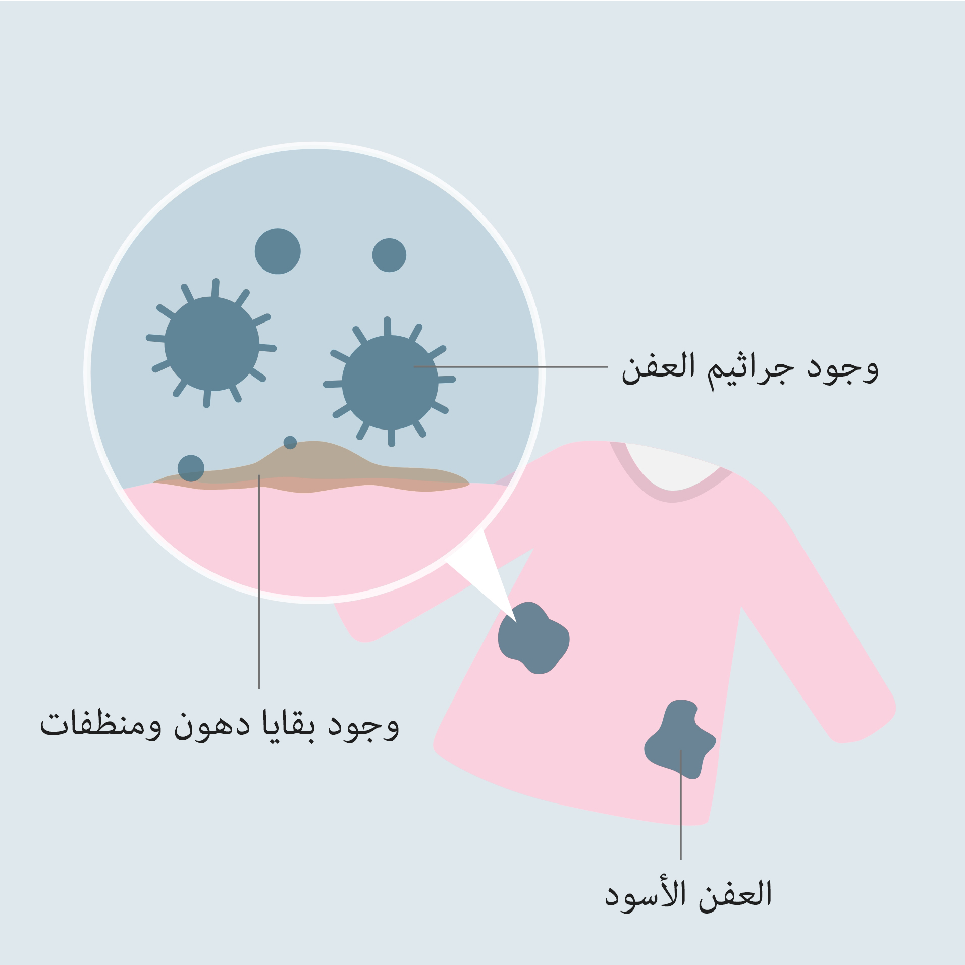 رسم توضيحي يُظهر العفن الأسود على الملابس، مع صورة مقربة لجراثيم العفن وبقايا الزهم والمنظفات.