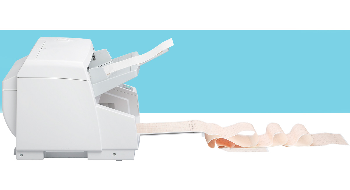 Detec&ccedil;&atilde;o de alimenta&ccedil;&atilde;o dupla 
ultrass&ocirc;nica