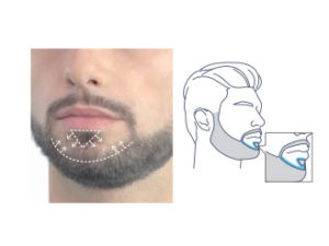 5. Soul Patch Shaping to a Triangle (Soul Patch)