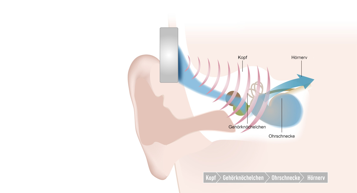 Einfaches Hörerlebnis