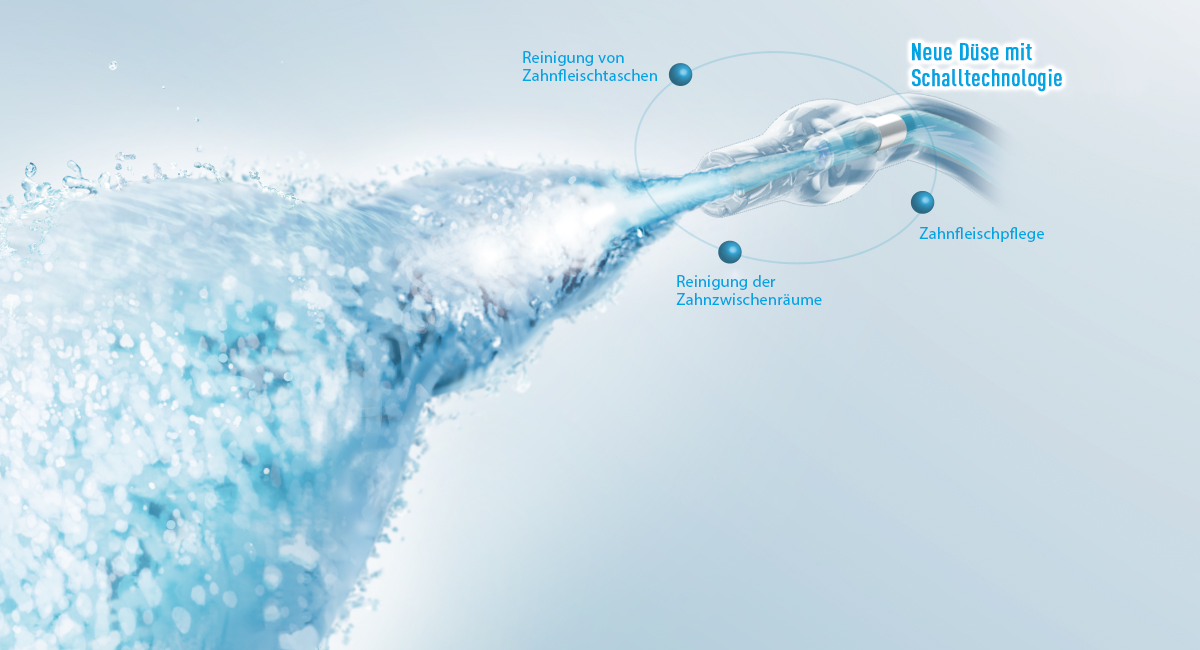 
Die 3 Vorteile des Ultraschall-Wasserstrahls