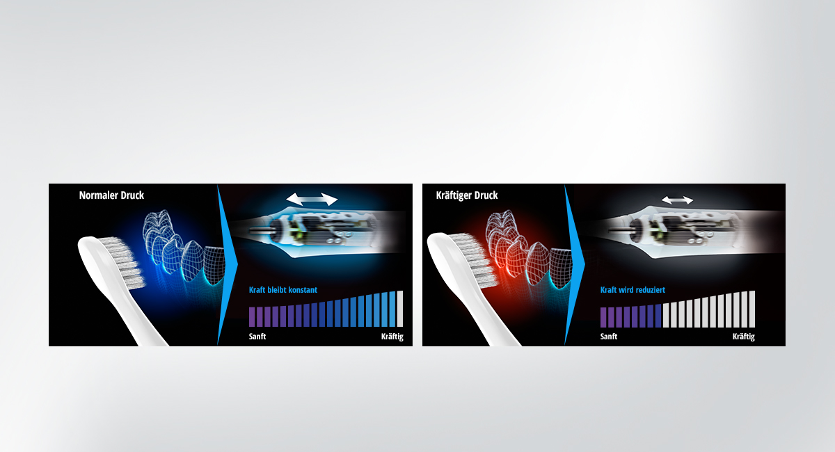 Leistungsregelung zur Minimierung der Belastung der Zahnfleischr&auml;nder
