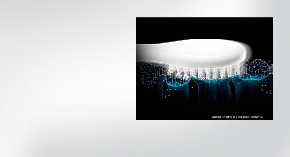 Mouvement sur la ligne gingivale