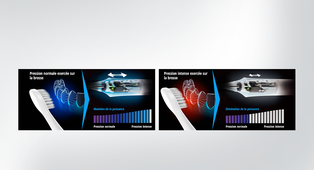Contrôle de la puissance visant à minimiser la charge sur les gencives