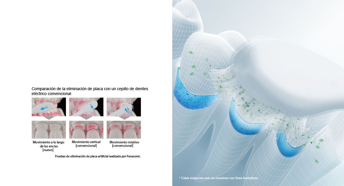 Movimiento a lo largo de las encías