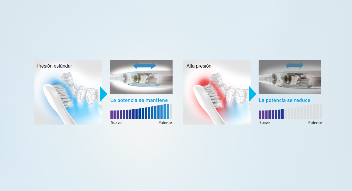 Control de potencia para minimizar la sobrecarga en dientes y encías