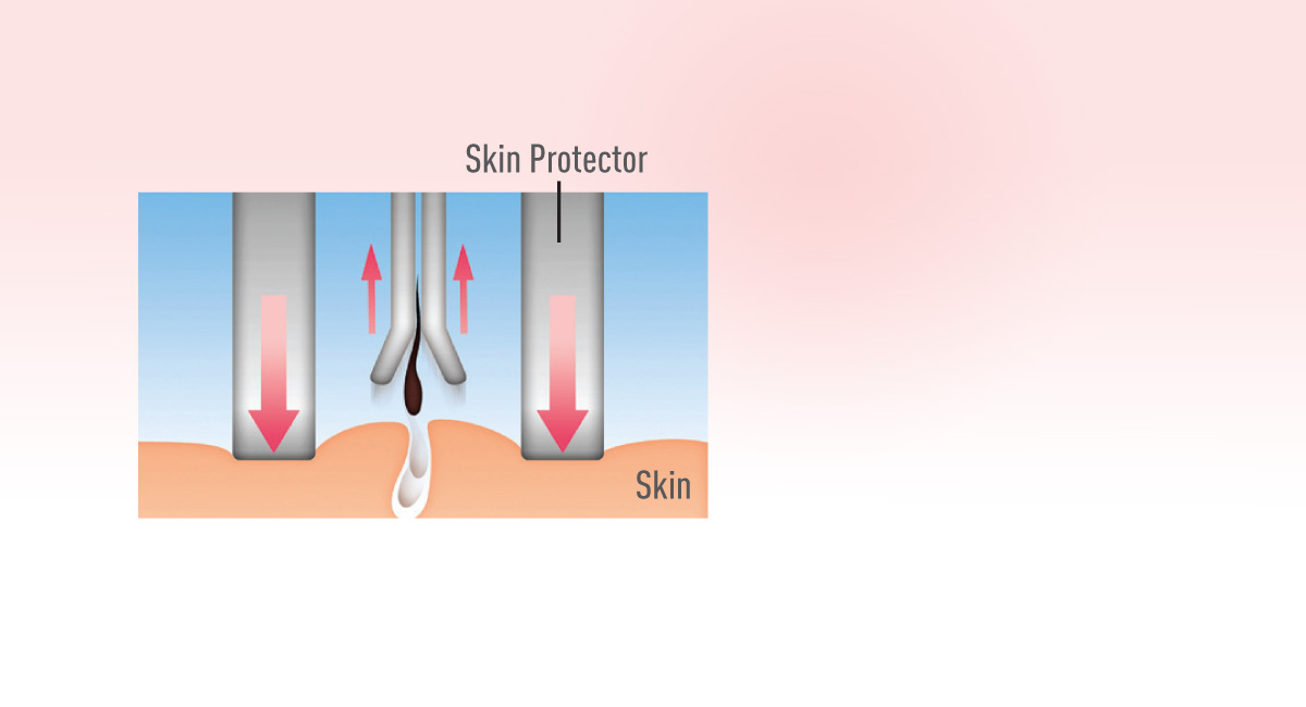 Skin Protector for Less Pain