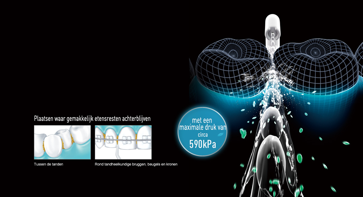 De krachtige waterstraal verwijdert bacteriën en etensresten uit holtes waar tandenborstels niet bij kunnen