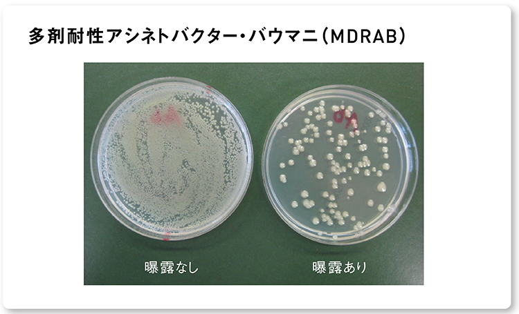 画像：ナノイー（帯電微粒子水）を2時間曝露した後の多剤耐性アシネトバクター・バウマニ（MDRAB）の 生菌数減少の様子