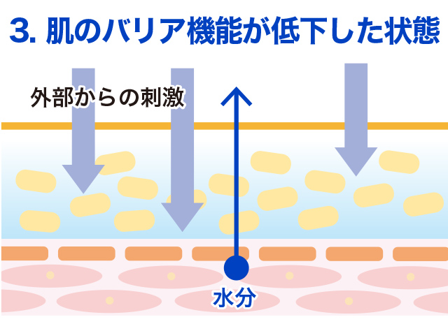 画像：肌のバリア機能が低下した状態 外部からの刺激 水分