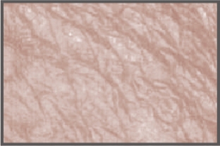 Skin texture