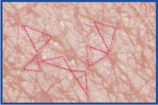 [14 days later] Skin texture