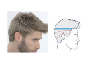 1. Sectioning (Sides)