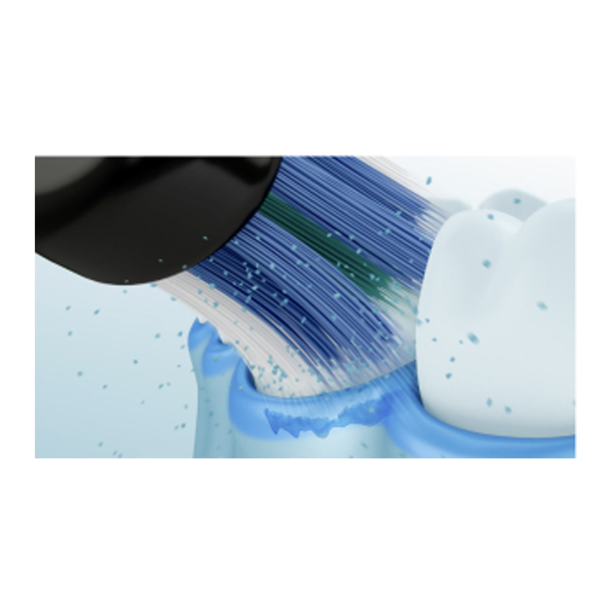 1. Parodontale pockets: