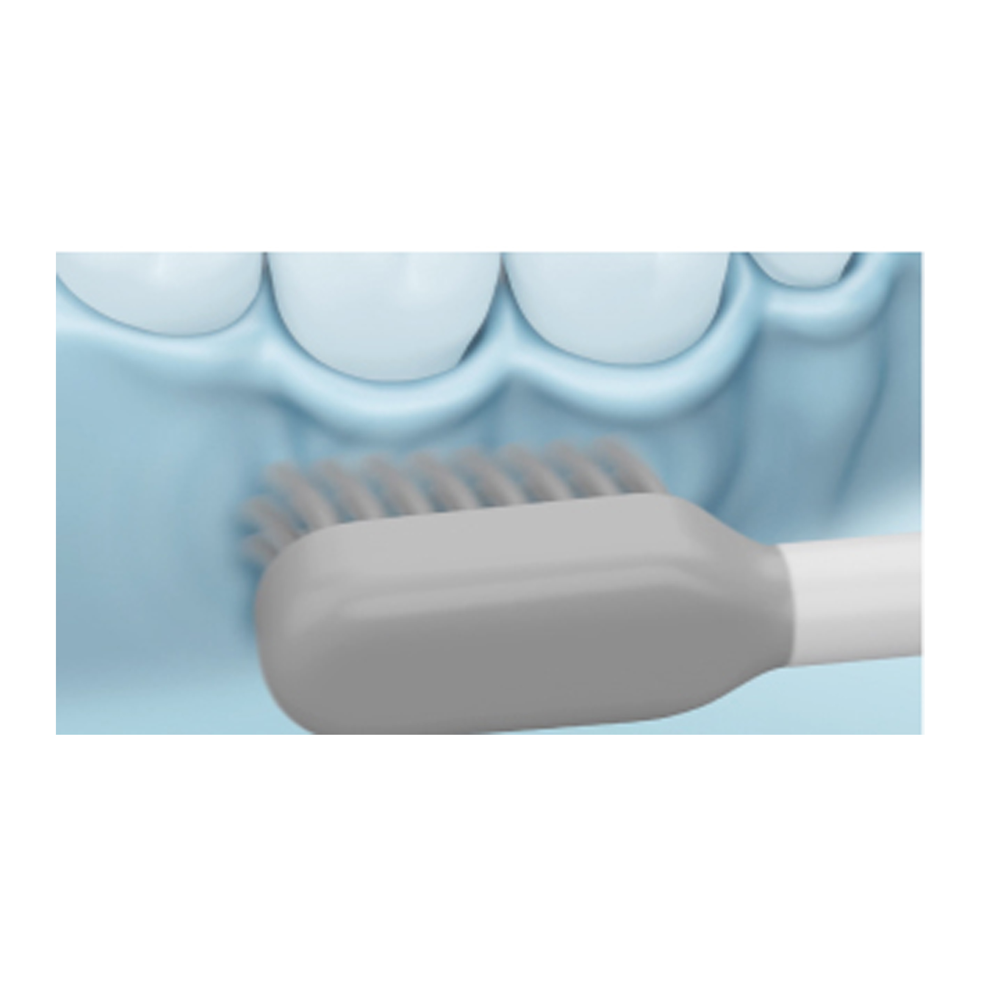 5. Bijtoppervlakken van tanden en kiezen: