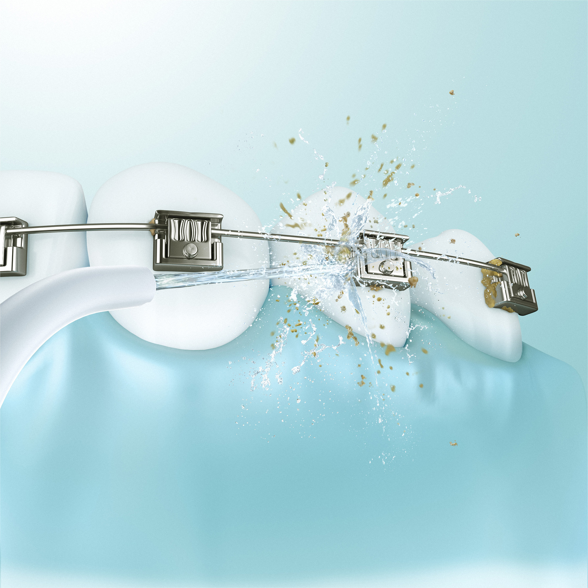 Limpeza eficaz para quem usa aparelhos ortodônticos