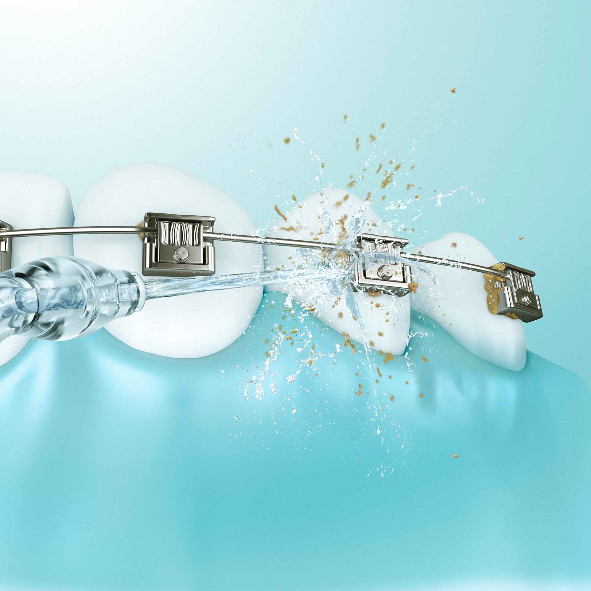 Nettoie autour des appareils orthodontiques.