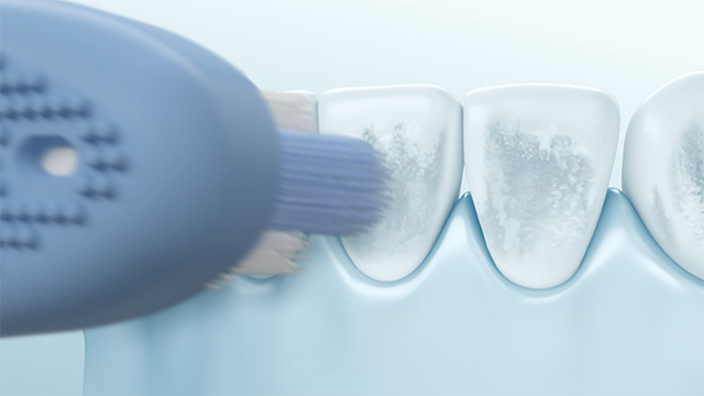 Vídeo sobre el cepillo antimanchas