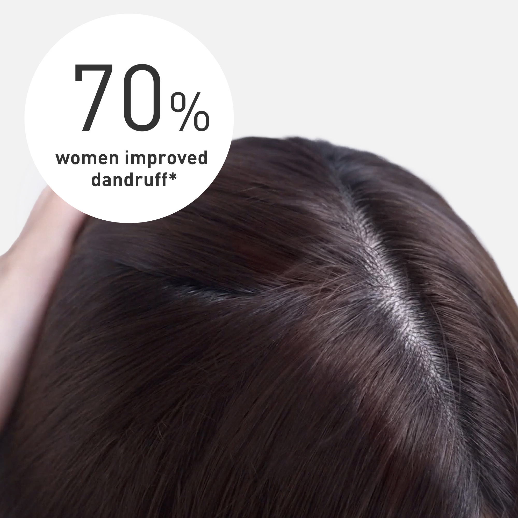 Reduced dandruff