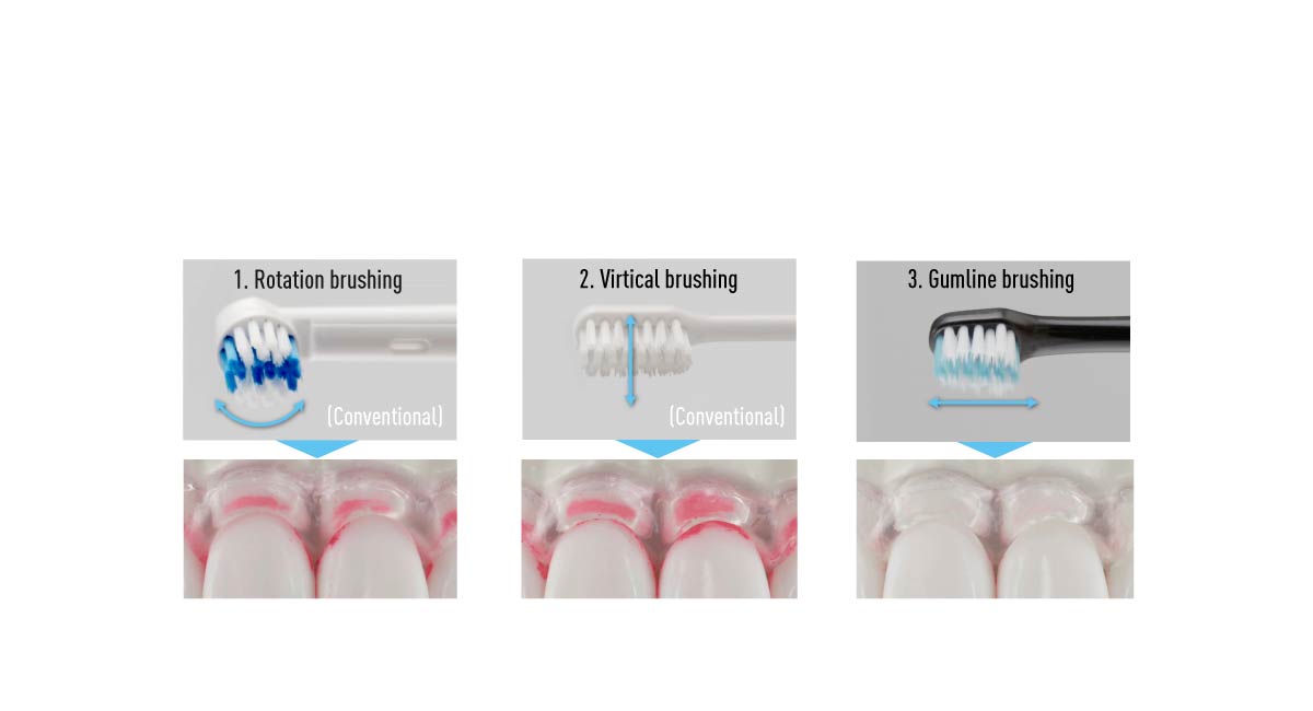 Comparison of brushing results*¹