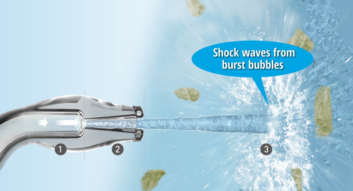 Ultrasonic Technology Mechanism