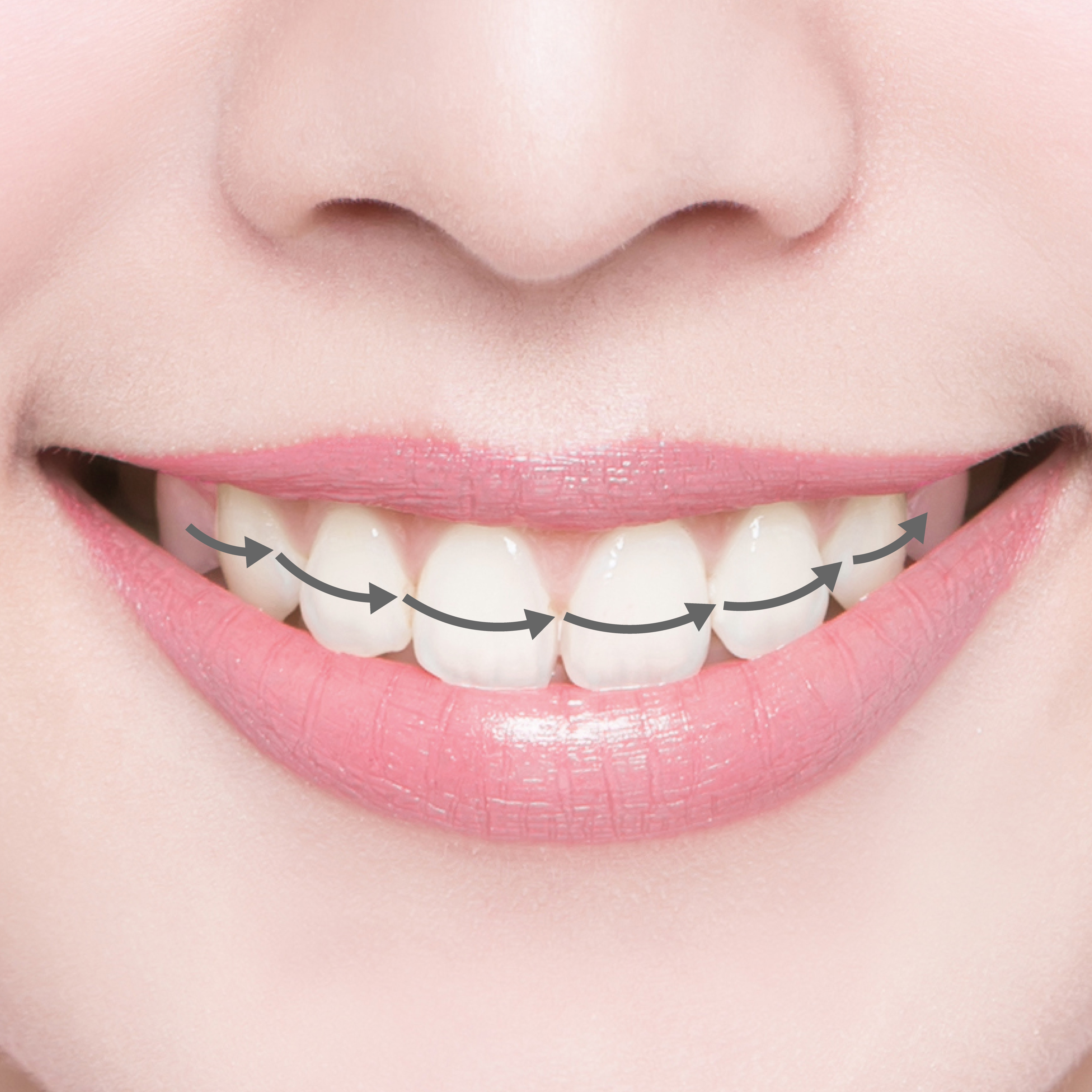 Chế Độ Vệ Sinh Kẽ Răng