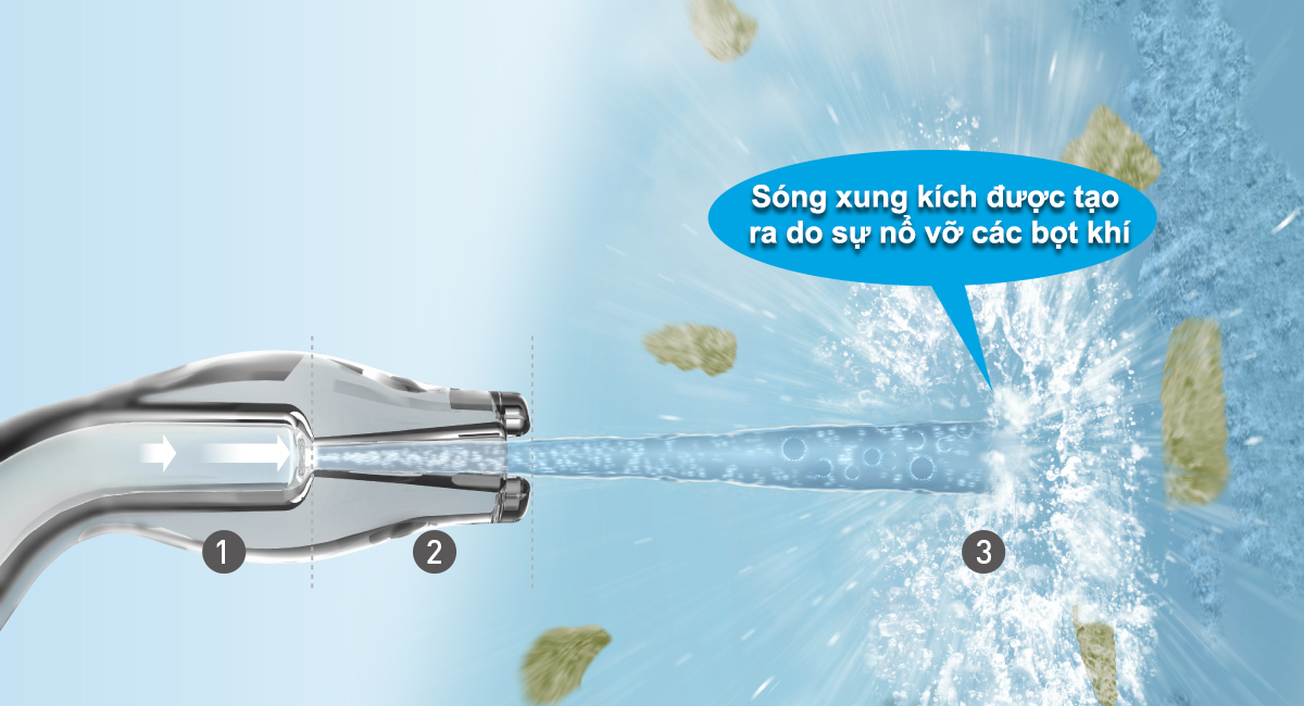 Cơ chế của công nghệ siêu âm