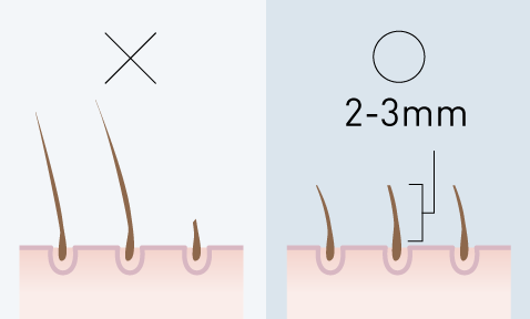 Tips for Epilation Tips for Epilation