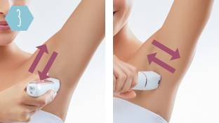 Two discs rotating in opposite directions ensures that all hair growing in various directions are caught Two discs rotating in opposite directions ensures that all hair growing in various directions are caught