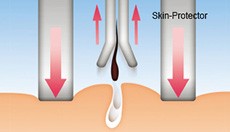 Skin-Protector-Aufsatz für weniger Schmerz