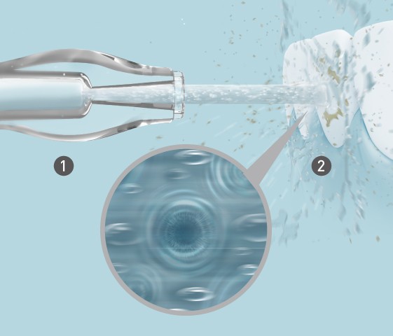 Ultraschalltechnologie für eine effektive Reinigung