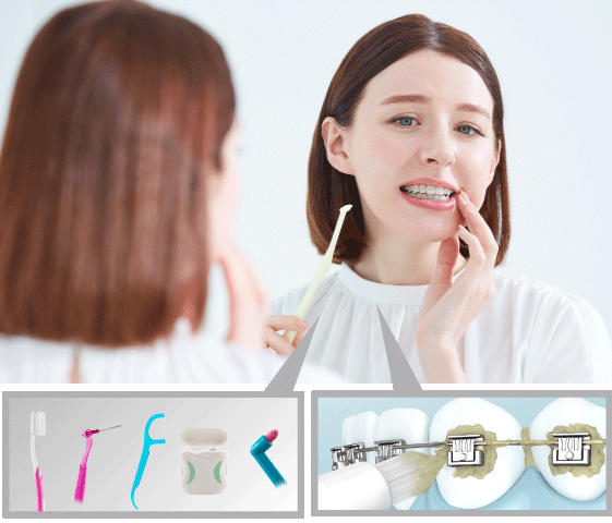 Les soins de la bouche peuvent se révéler pénibles pour les patients en orthodontie