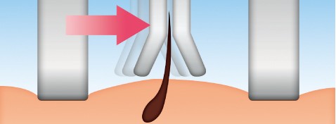 Protezione delicata per la pelle
