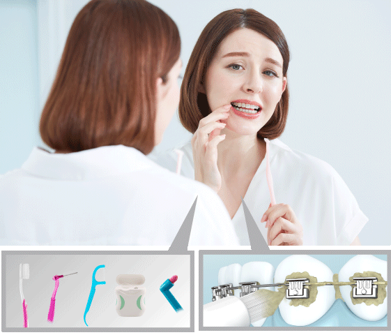 Burnos priežiūra ortodontų pacientams kelia daug rūpesčių