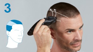 STEP 3: Sides and back