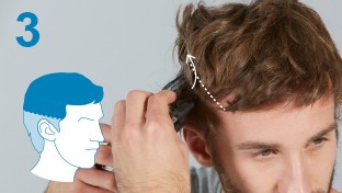 الخطوة 3: الصدغ